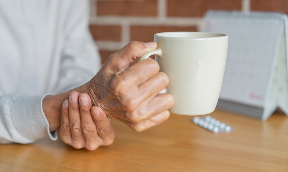 Parkinsonizam